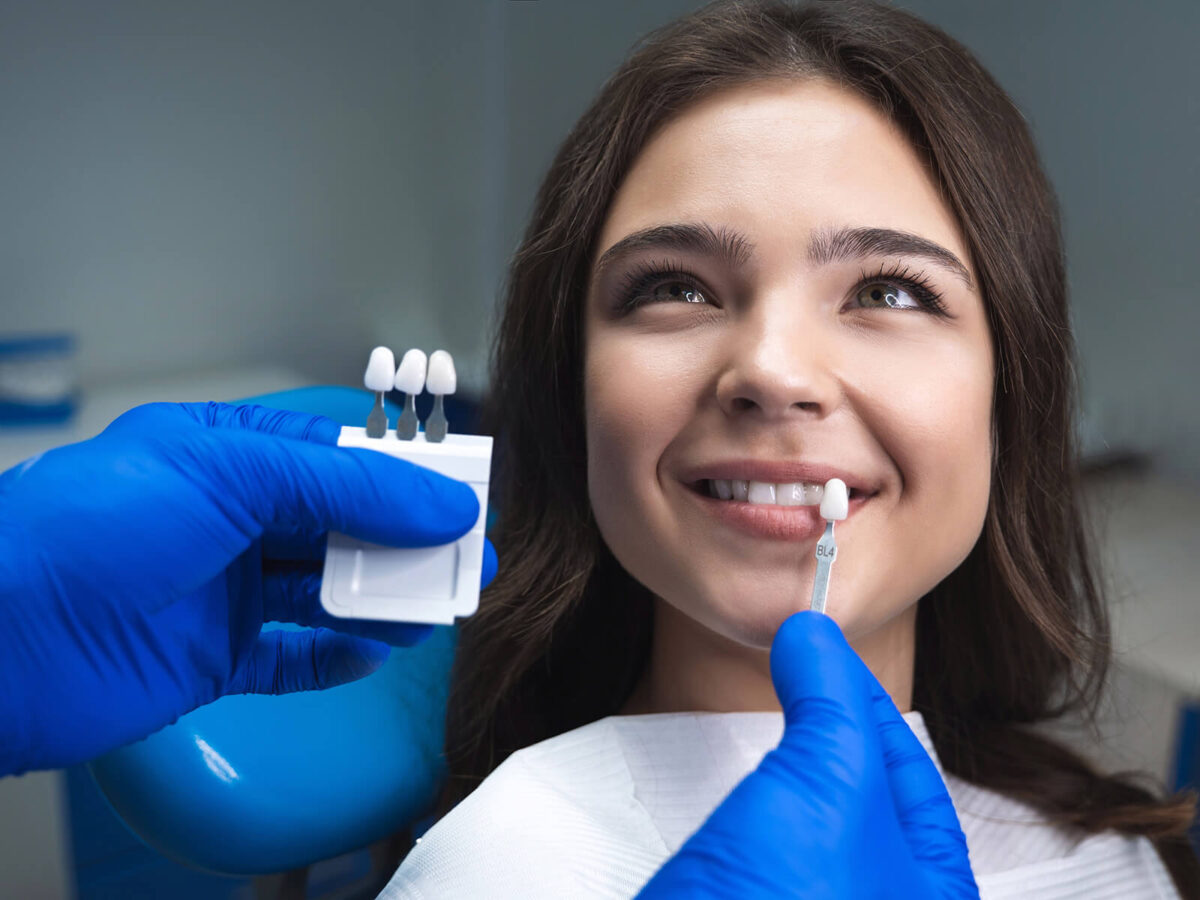 The Pros and Cons of Dental Veneers