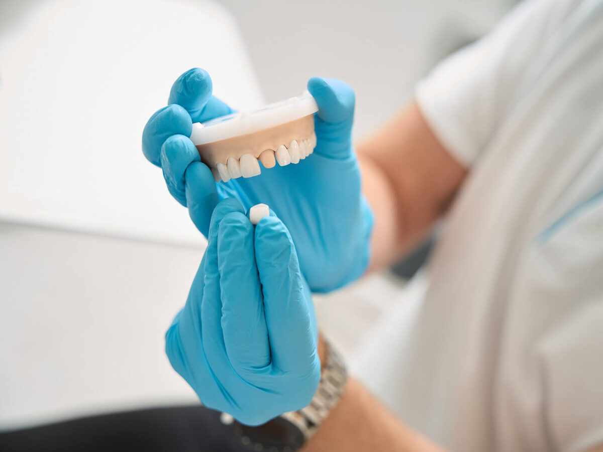 4 Signs Your Dental Crown Needs To Be Replaced