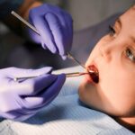 The Pros And Cons of Dental Sealants: What You Need To Know