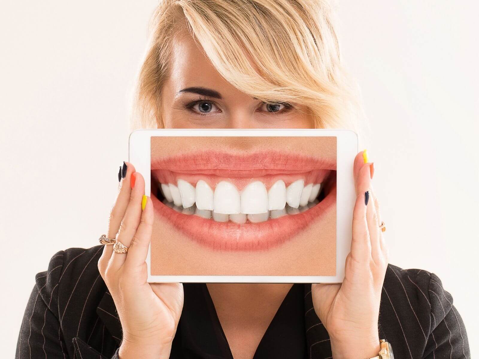 Does Laser Teeth Whitening Have Any Side Effects?